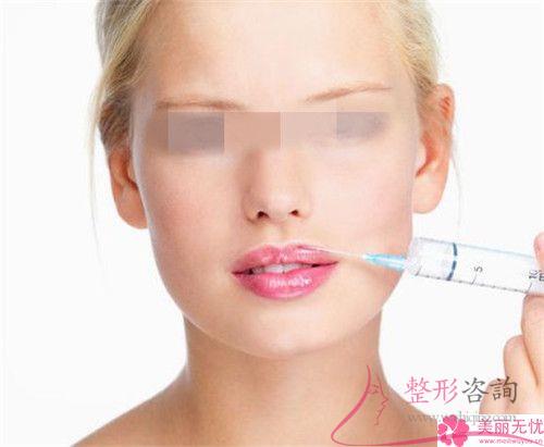 <a href=http://m.f3bb6.cn/listinfo-731-0.html target=_blank class=infotextkey>玻尿酸</a>注射豐嘴唇預測需要多少？