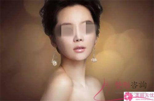 <a href=http://m.f3bb6.cn/listinfo-737-0.html target=_blank class=infotextkey>隆鼻</a>術整形效果有哪些