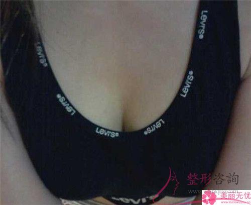 女性實施<a href=http://m.f3bb6.cn/listinfo-625-0.html target=_blank class=infotextkey>乳暈縮小</a>手術(shù)的成功率是100%嗎