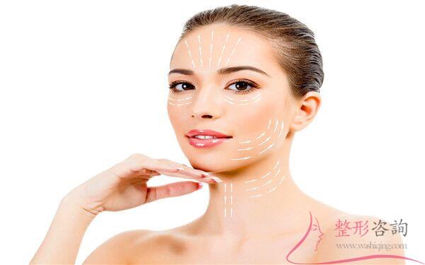 1402519881 1402519881