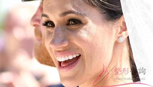 1655116260 1655116260