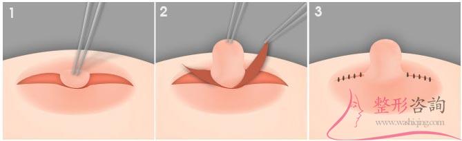 1904356853 1904356853