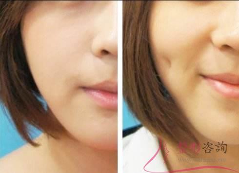 1647092932 1647092932