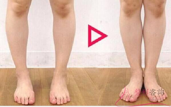 1509302930 1509302930