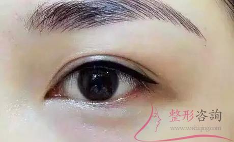 1039225112 1039225112