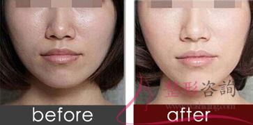 1452102045 1452102045