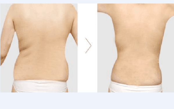 1511505171 1511505171