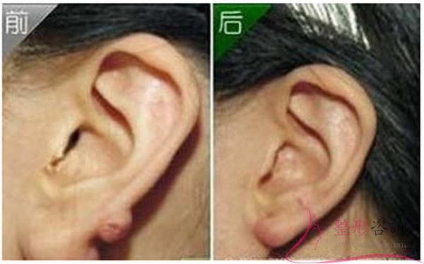 1029319704 1029319704