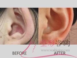 1811453431 1811453431