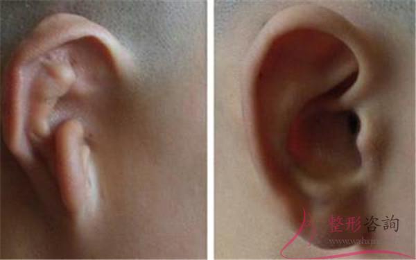 1413139468 1413139468