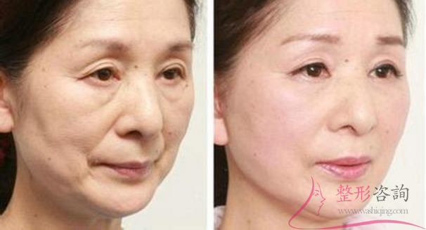 1405442862 1405442862