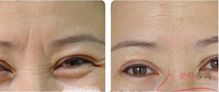 1421025160 1421025160