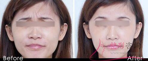 1430536344 1430536344