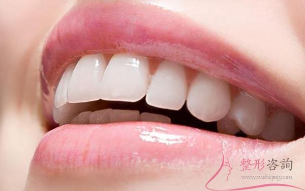 1518402617 1518402617