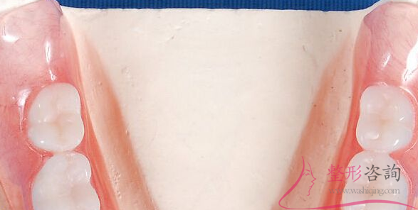 0848511406 0848511406