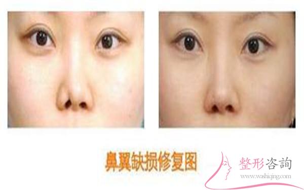 1426235406 1426235406