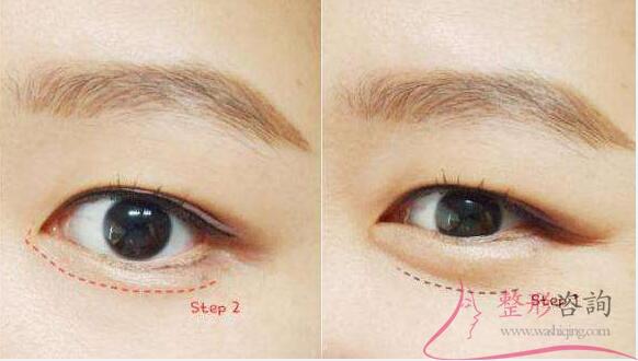 0943465604 0943465604