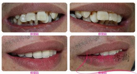 1512239643 1512239643