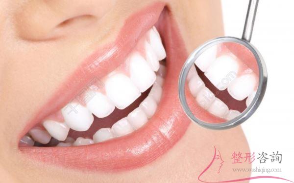 1537148732 1537148732