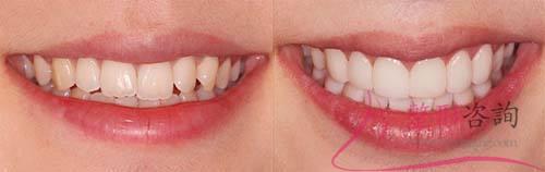 1949185883 1949185883