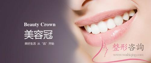 2014199034 2014199034