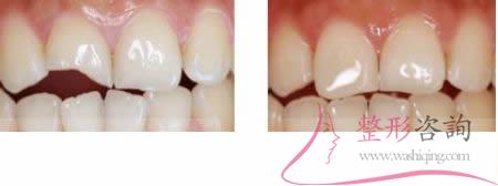 2122036823 2122036823