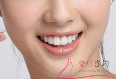 1617571294 1617571294