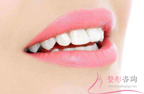 1618196734 1618196734