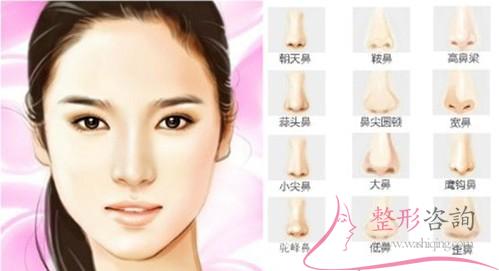 1156232976 1156232976