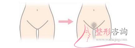 1734109069 1734109069