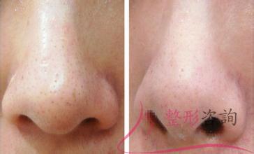 0032039649 0032039649