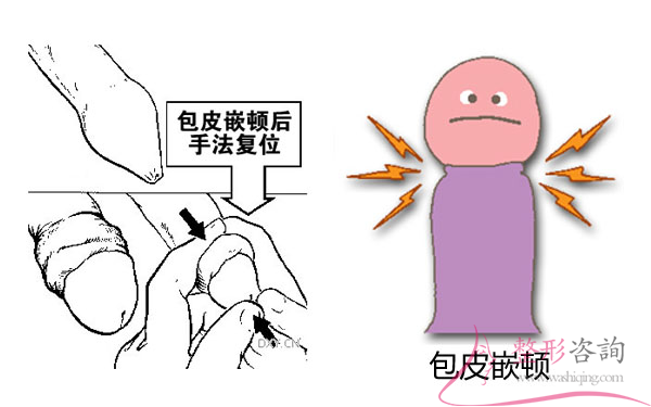 1425061351 1425061351