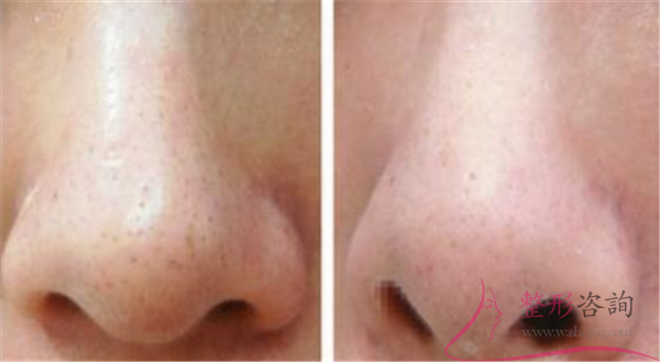 1452106031 1452106031