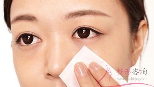 1935432338 1935432338