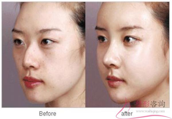 1558011815 1558011815