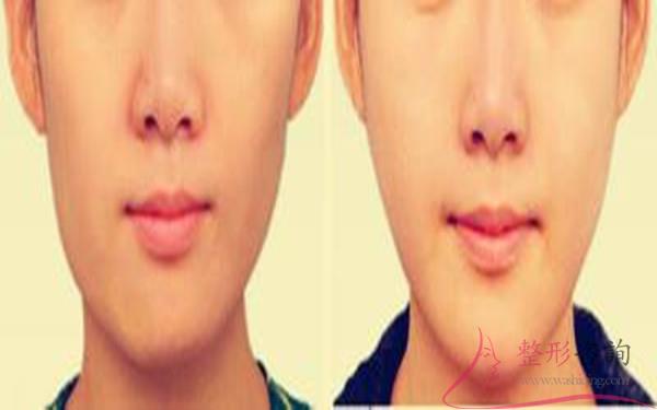 1027264821 1027264821