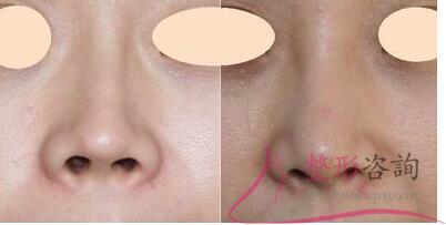 1114287947 1114287947