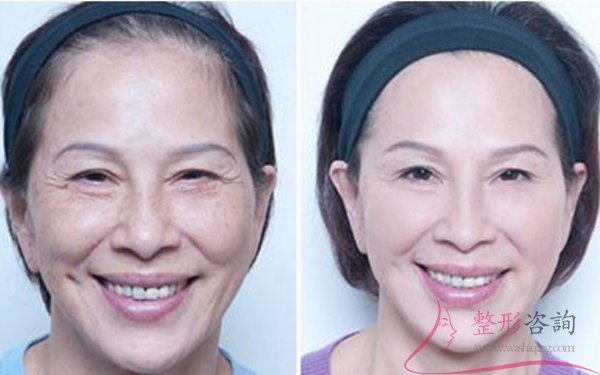 1455316798 1455316798