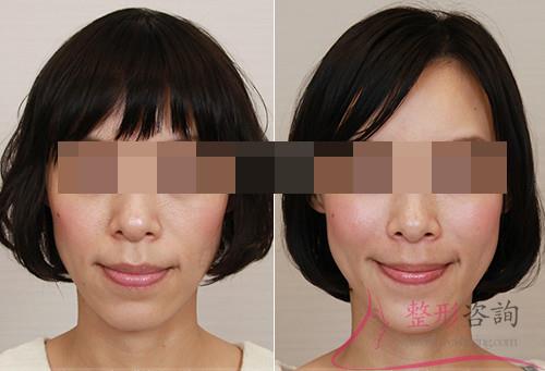 1645024882 1645024882