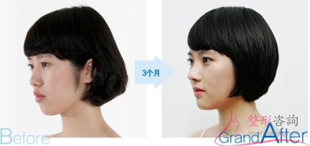 1225004364 1225004364