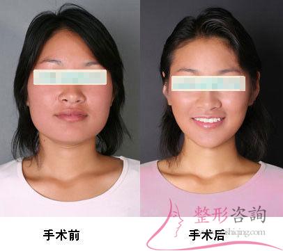 1810435828 1810435828