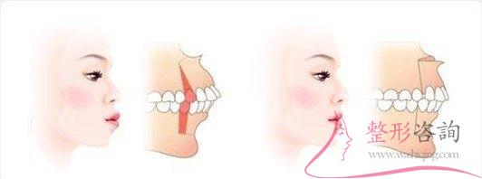 1435565022 1435565022