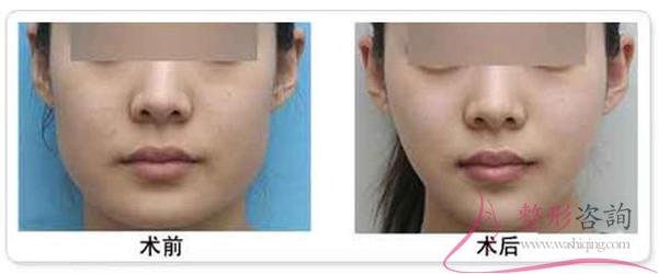 1544127875 1544127875