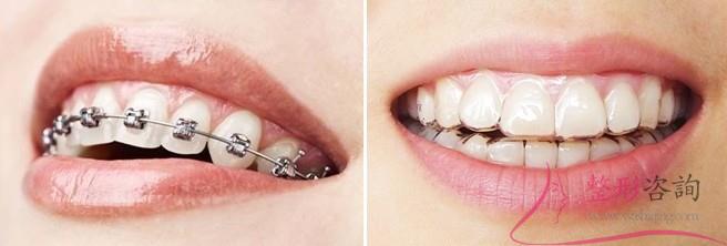 1714014903 1714014903