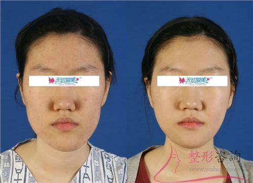 1918145712 1918145712