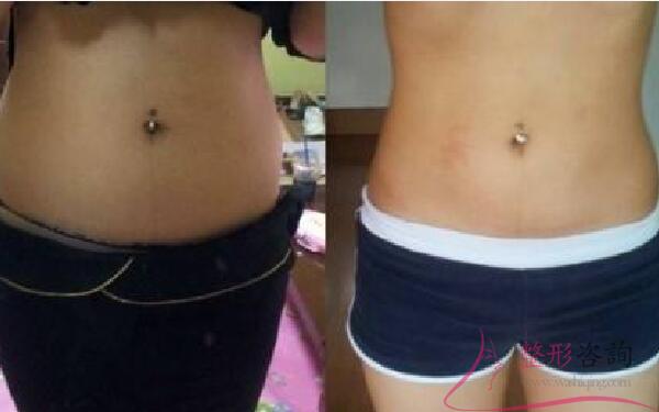 1409128585 1409128585