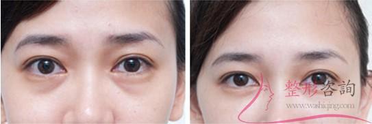 1106066965 1106066965