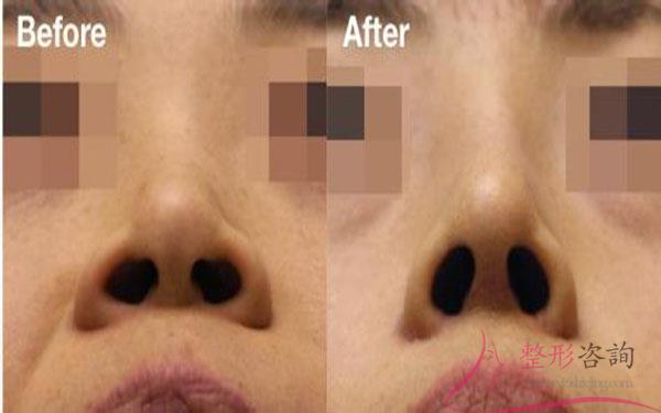 0120086952 0120086952