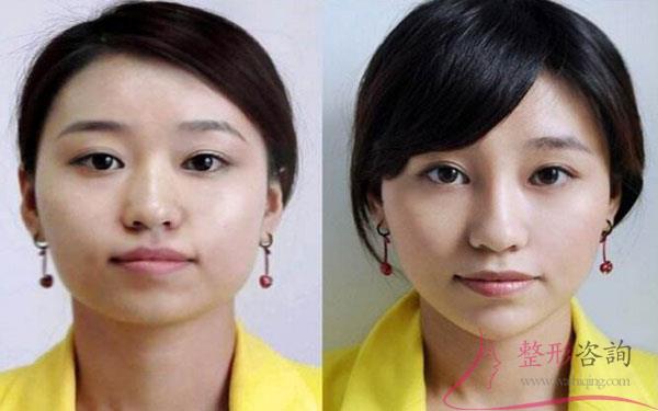 1636426233 1636426233