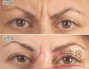 1009517961 1009517961